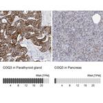 COQ3 Antibody