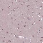 CLCN4 Antibody in Immunohistochemistry (IHC)