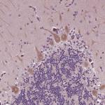 CLCN4 Polyclonal Antibody