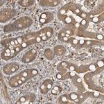HHLA3 Antibody in Immunohistochemistry (Paraffin) (IHC (P))