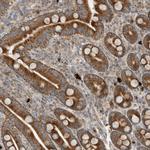 CPAMD8 Antibody in Immunohistochemistry (Paraffin) (IHC (P))