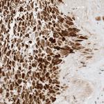 CPAMD8 Antibody in Immunohistochemistry (Paraffin) (IHC (P))