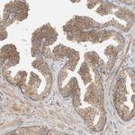 CPAMD8 Antibody in Immunohistochemistry (Paraffin) (IHC (P))