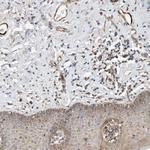 CPAMD8 Polyclonal Antibody