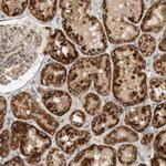 CPAMD8 Antibody in Immunohistochemistry (Paraffin) (IHC (P))