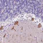 CLSTN2 Polyclonal Antibody