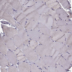 TSPYL5 Antibody in Immunohistochemistry (Paraffin) (IHC (P))