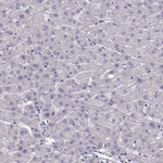 TSPYL5 Antibody in Immunohistochemistry (Paraffin) (IHC (P))