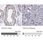 TSPYL5 Antibody in Immunohistochemistry (IHC)