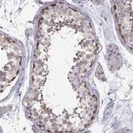TSPYL5 Antibody in Immunohistochemistry (IHC)