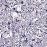TSPYL5 Antibody in Immunohistochemistry (IHC)