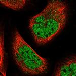 BTBD6 Polyclonal Antibody