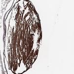 BTBD6 Antibody in Immunohistochemistry (IHC)