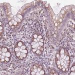 BSDC1 Antibody in Immunohistochemistry (Paraffin) (IHC (P))