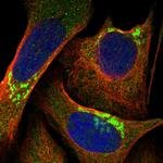 BSDC1 Polyclonal Antibody