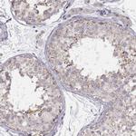 UBL4B Antibody in Immunohistochemistry (IHC)
