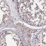 UBL4B Antibody in Immunohistochemistry (IHC)