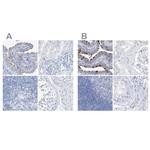 C1orf87 Polyclonal Antibody