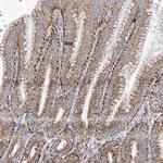 CPNE5 Antibody in Immunohistochemistry (Paraffin) (IHC (P))