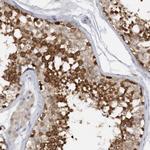DDX43 Antibody in Immunohistochemistry (Paraffin) (IHC (P))