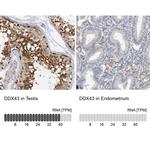 DDX43 Antibody in Immunohistochemistry (IHC)