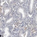 DDX43 Antibody in Immunohistochemistry (IHC)