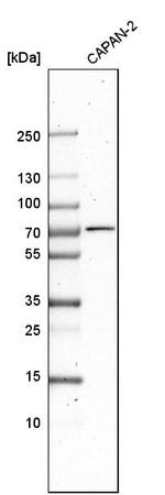 DDX43 Antibody in Western Blot (WB)