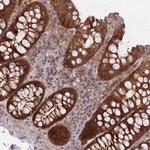 PREP Polyclonal Antibody