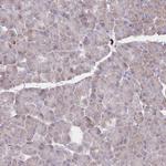 PREP Antibody in Immunohistochemistry (Paraffin) (IHC (P))