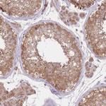 PREP Antibody in Immunohistochemistry (Paraffin) (IHC (P))