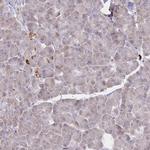 PREP Antibody in Immunohistochemistry (IHC)