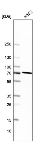 PREP Antibody in Western Blot (WB)