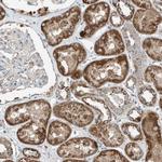 RMND1 Antibody in Immunohistochemistry (Paraffin) (IHC (P))