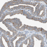 RMND1 Antibody in Immunohistochemistry (Paraffin) (IHC (P))