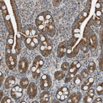 RMND1 Antibody in Immunohistochemistry (Paraffin) (IHC (P))