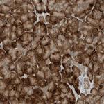 RMND1 Polyclonal Antibody