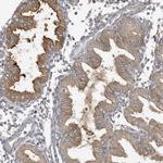 LAPTM4A Antibody in Immunohistochemistry (IHC)