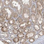 LAPTM4A Antibody in Immunohistochemistry (IHC)