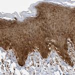 LAPTM4A Antibody in Immunohistochemistry (IHC)