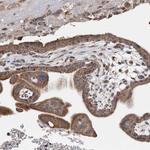 WFDC1 Antibody in Immunohistochemistry (Paraffin) (IHC (P))