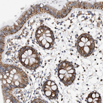 WFDC1 Antibody in Immunohistochemistry (Paraffin) (IHC (P))
