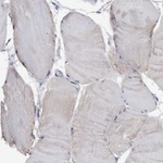 WFDC1 Antibody in Immunohistochemistry (Paraffin) (IHC (P))