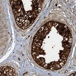 AGA Antibody in Immunohistochemistry (IHC)