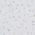 AGA Antibody in Immunohistochemistry (IHC)