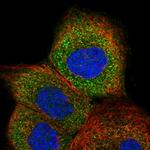 GTPBP2 Antibody in Immunocytochemistry (ICC/IF)