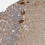 GTPBP2 Antibody in Immunohistochemistry (IHC)