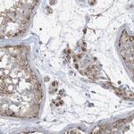 GTPBP2 Antibody in Immunohistochemistry (IHC)