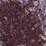 Themis Polyclonal Antibody