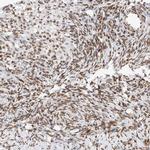 ZNF512 Antibody in Immunohistochemistry (IHC)