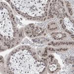 KRTAP25-1 Antibody in Immunohistochemistry (Paraffin) (IHC (P))